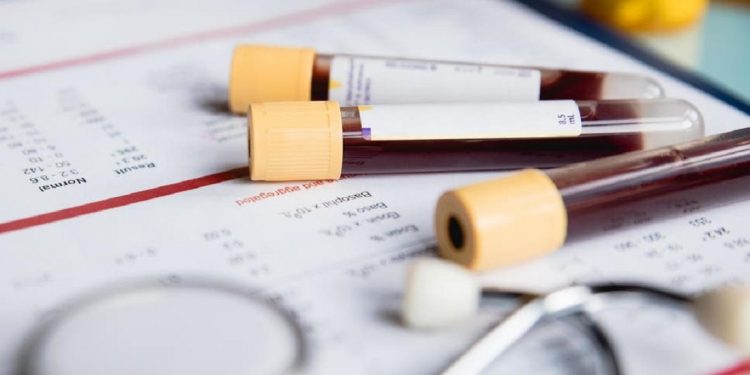 Blood cancer patients are more likely to die from coronavirus than patients with other forms of the disease