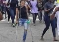 End SARS protester without limb