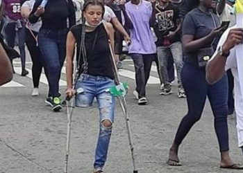 End SARS protester without limb