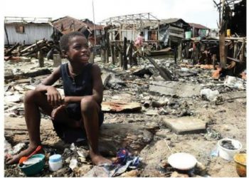 Urban slums and health challenges