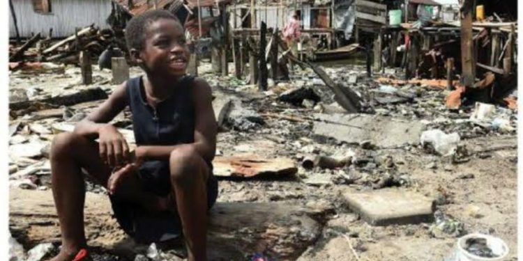 Urban slums and health challenges