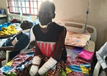 Gunmen cut off man hand