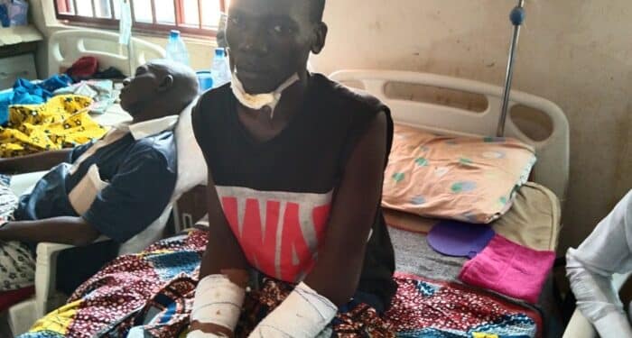 Gunmen cut off man hand