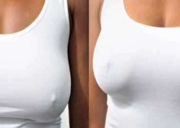 Sagging Breasts vs Firm Breasts