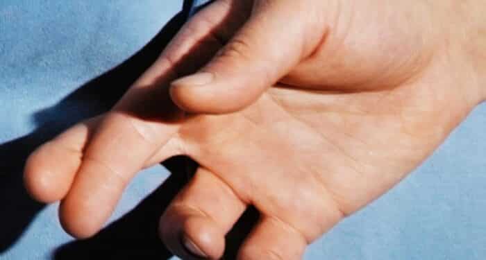 How to spot a lair while text messaging