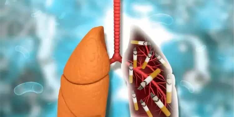 Smoking and Lung Cancer