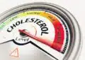 Cholesterol Level