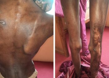 Teenage Girl Locked Up By Aunt