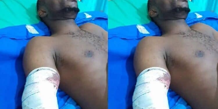 Animal Feed Company Factory Machine Cuts Off Worker’s Hand In Ogun