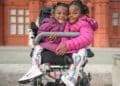 Conjoined Twins