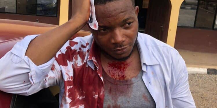 Journalists Demand Justice For Brutalised by DSS