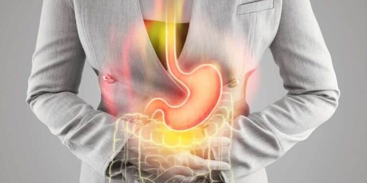 Stomach ulcers gastric ulcers ulcer