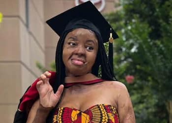 Kechi Okwuchi - Woman Who Survived Plane Crash Earns Master's Degree With Distinction