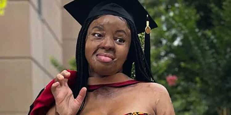 Kechi Okwuchi - Woman Who Survived Plane Crash Earns Master's Degree With Distinction