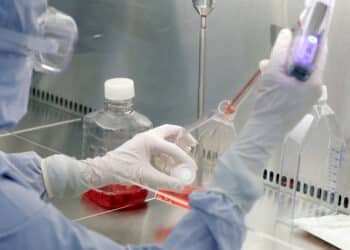 Sickle Cell anaemia treatment