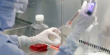 Sickle Cell anaemia treatment