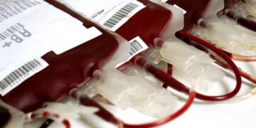 Jehovah’s Witnesses and Blood transfusion principle