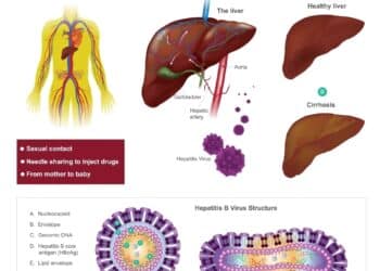 Hepatitis B Virus